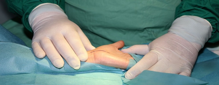 Best Carpal Tunnel Surgery in Altrincham, UK